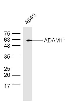 ADAM11 Rabbit Polyclonal Antib