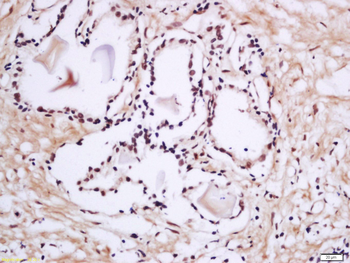 Phospho-PRKCB (Thr642) Rabbit 