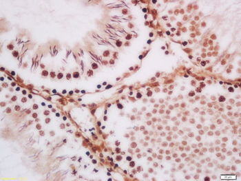TLK1 Rabbit Polyclonal Antibod