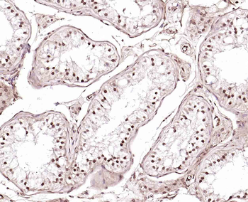 CLK2 Rabbit Polyclonal Antibod