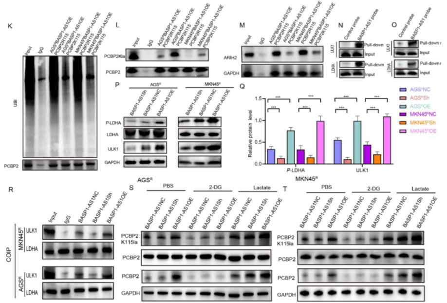 AtaGenix定制乳酰化抗体助力解析BASP1-AS1–PCBP2通路，揭示胃癌奥沙利铂耐药新机制