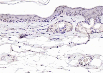Phospho-P53 (Ser392) Rabbit Po