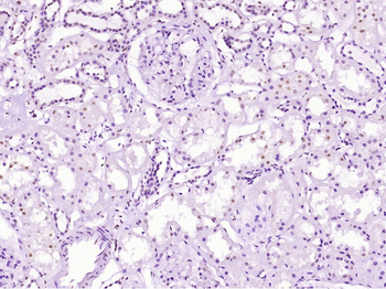 Phospho-DDX5 (Tyr593) Rabbit P