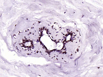 Phospho-YAP1 (Tyr407) Rabbit P