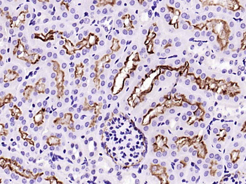 ACE2 Recombinant Rabbit Monocl