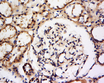 DFFA Rabbit Polyclonal Antibod