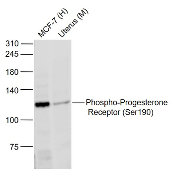 Phospho-Progesterone Receptor