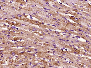 TFPI-2 Rabbit Polyclonal Antib