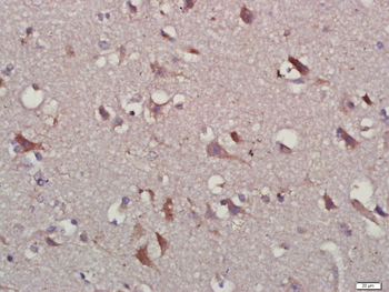 IL-10 Rabbit Polyclonal Antibo