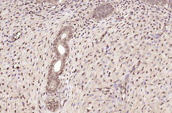 Phospho-IRS1 (Tyr1229) Rabbit 