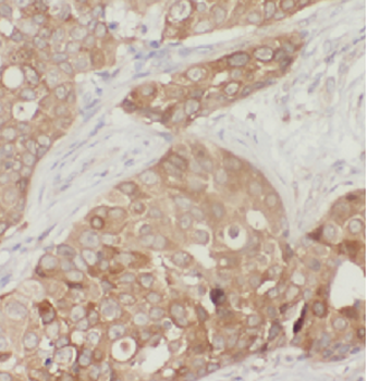 ATF4 Antibody抗体，orb624932，bior