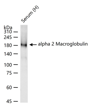 Alpha 2 Macroglobulin Rabbit P