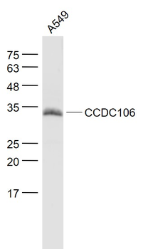 CCDC106 Rabbit Polyclonal Anti