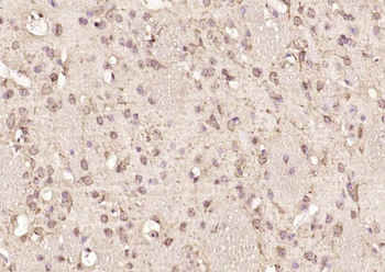 NUP160 Rabbit Polyclonal Antib