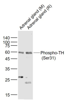 Phospho-TH (Ser31) Rabbit Poly
