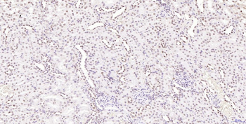 Phospho-H2AX (Ser139) Recombin