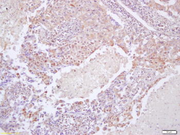 Phospho-eIF4EBP1 (Thr37 + Thr4