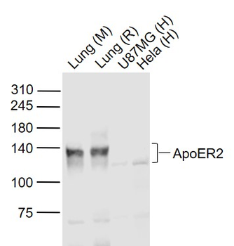 ApoER2 Rabbit Polyclonal Antib
