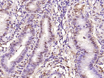 Galectin 3 Mouse Monoclonal An