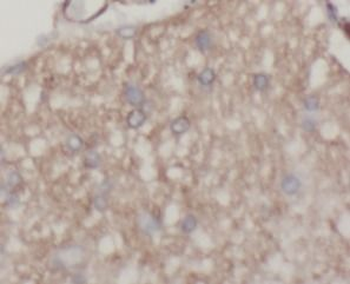 Beta Tubulin Antibody抗体,orb625