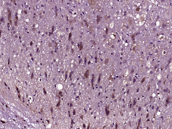 ID2 Rabbit Polyclonal Antibody