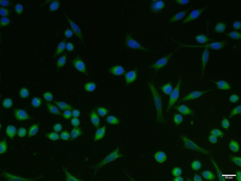 CK10 Rabbit Polyclonal Antibod