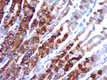 PRC1 Rabbit Polyclonal Antibod