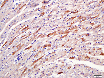 DMT1 Rabbit Polyclonal Antibod