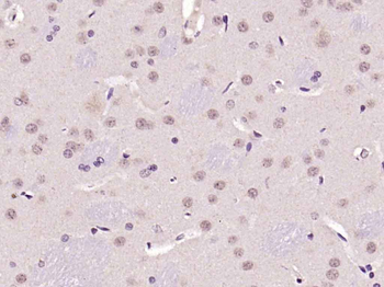 Ferritin Heavy Chain/FTH1 Rabb