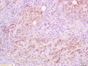 CD5L Rabbit Polyclonal Antibod