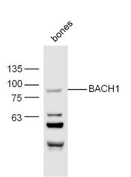 BACH1 Rabbit Polyclonal Antibo