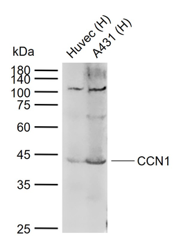 CCN1 Rabbit Polyclonal Antibod