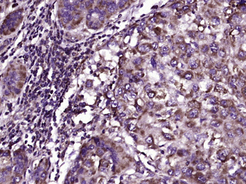 KATNA1 Rabbit Polyclonal Antib