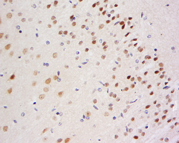 BACH1 Rabbit Polyclonal Antibo