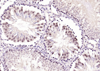 BNC1 Rabbit Polyclonal Antibod