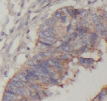 ASCC2 Antibody抗体，orb624901，bio