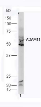 ADAM11 Rabbit Polyclonal Antib