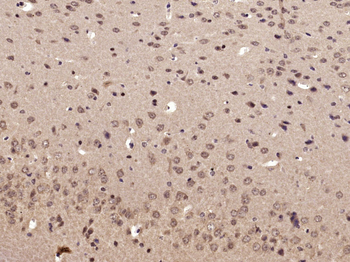 Phospho-RPS6KB1 (Ser417) Rabbi