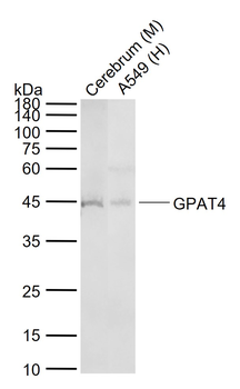 GPAT4 Rabbit Polyclonal Antibo