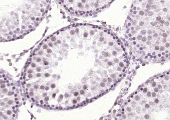 AKR1D1 Rabbit Polyclonal Antib