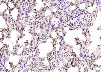 Phospho-SLK (Tyr530) Rabbit Po