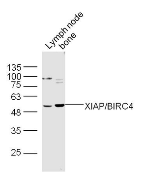 XIAP/BIRC4 Rabbit Polyclonal A