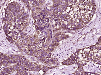 TFF2 Rabbit Polyclonal Antibod