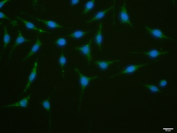 ATG1/ULK1 Rabbit Polyclonal An