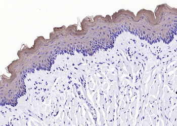Cytokeratin 4 Recombinant Rabb