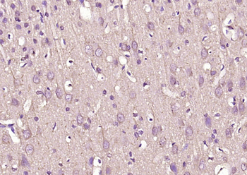 VAT1L Rabbit Polyclonal Antibo