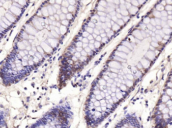 Galectin 3 Mouse Monoclonal An