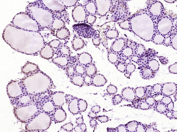 RUNX2 Rabbit Polyclonal Antibo