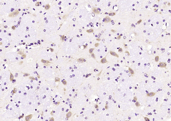 NALP12 Rabbit Polyclonal Antib