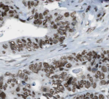 FUS Antibody抗体,orb395058,biorb